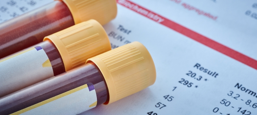 How to Read Your Blood Tests Like a Centenarian-in-Training